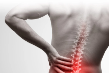 Sciatica Pain